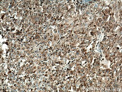 Cathepsin L Rabbit Polyclonal Antibody, Proteintech:Antibodies:Primary