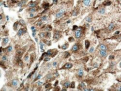 Cathepsin L Rabbit Polyclonal Antibody, Proteintech:Antibodies:Primary