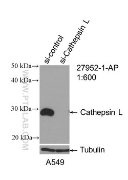 Cathepsin L Rabbit Polyclonal Antibody, Proteintech:Antibodies:Primary