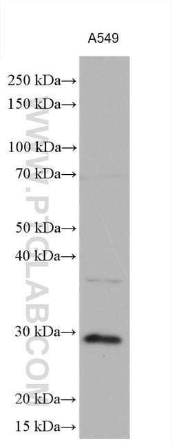 Cathepsin L Rabbit Polyclonal Antibody, Proteintech:Antibodies:Primary