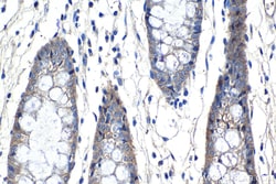 Claudin 5 Rabbit Polyclonal Antibody, Proteintech:Antibodies:Primary Antibodies