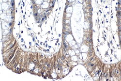 Claudin 5 Rabbit Polyclonal Antibody, Proteintech:Antibodies:Primary Antibodies
