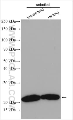 Claudin 5 Rabbit Polyclonal Antibody, Proteintech:Antibodies:Primary Antibodies