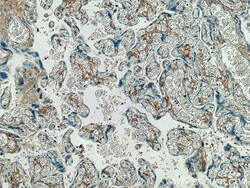 Collagen Type V Rabbit Polyclonal Antibody, Proteintech Unconjugated; 20