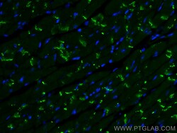 Connexin 43 Rabbit Recombinant Antibody, Proteintech:Antibodies:Primary