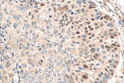 Cyclin D1 Rabbit Recombinant Antibody, Proteintech Unconjugated; 20 &mu;L:Antibodies,
