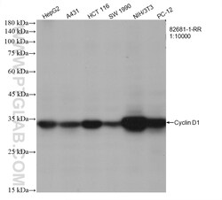 Cyclin D1 Rabbit Recombinant Antibody, Proteintech Unconjugated; 20 &mu;L:Antibodies,