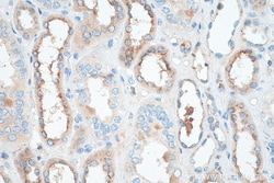 Cystatin C Rabbit Recombinant Antibody, Proteintech:Antibodies:Primary