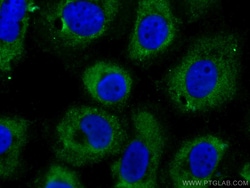 CoraLite 488-conjugated Cytokeratin 14 Mouse Monoclonal Antibody, Proteintech:Antibodies:Primary