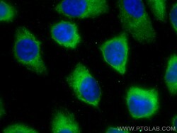 CoraLite 488-conjugated Cytokeratin 14 Mouse Monoclonal Antibody, Proteintech:Antibodies:Primary