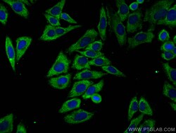 CoraLite 488-conjugated Cytokeratin 14 Mouse Monoclonal Antibody, Proteintech:Antibodies:Primary