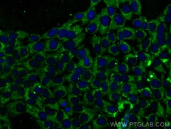 CoraLite 488-conjugated Cytokeratin 14 Mouse Monoclonal Antibody, Proteintech:Antibodies:Primary