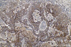 Cytokeratin 5/6 Mouse Monoclonal Antibody, Proteintech Unconjugated; 150