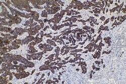 Cytokeratin 5/6 Mouse Monoclonal Antibody, Proteintech Unconjugated; 150