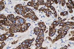 Cytokeratin 5/6 Mouse Monoclonal Antibody, Proteintech Unconjugated; 150