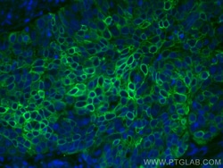 CoraLite Plus 488-conjugated Cytokeratin 5 Mouse Monoclonal Antibody, Proteintech