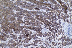 Cytokeratin 6A Mouse Monoclonal Antibody, Proteintech 150 &mu;L | Buy Online | Proteintech | Fisher Scientific