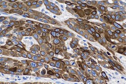 Cytokeratin 6A Mouse Monoclonal Antibody, Proteintech 150 &mu;L | Buy Online | Proteintech | Fisher Scientific