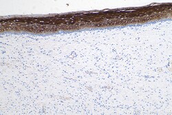 Cytokeratin 6A Mouse Monoclonal Antibody, Proteintech 150 &mu;L | Buy Online | Proteintech | Fisher Scientific