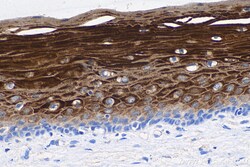 Cytokeratin 6A Mouse Monoclonal Antibody, Proteintech 150 &mu;L | Buy Online | Proteintech | Fisher Scientific