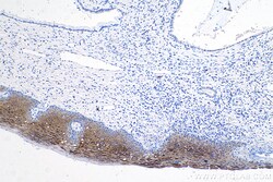Cytokeratin 6A Mouse Monoclonal Antibody, Proteintech 150 &mu;L | Buy Online | Proteintech | Fisher Scientific