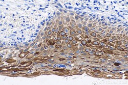 Cytokeratin 6A Mouse Monoclonal Antibody, Proteintech 150 &mu;L | Buy Online | Proteintech | Fisher Scientific