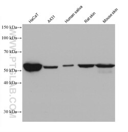 Cytokeratin 6A Mouse Monoclonal Antibody, Proteintech 150 &mu;L | Buy Online | Proteintech | Fisher Scientific