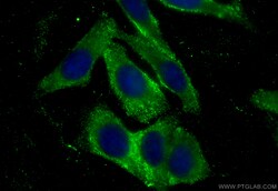 CoraLite Plus 488-conjugated D2HGDH Mouse Monoclonal Antibody, Proteintech:Antibodies:Primary