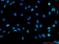 CoraLite Plus 488-conjugated DBR1 Mouse Monoclonal Antibody, Proteintech