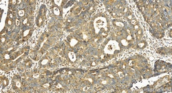 DCBLD2 Rabbit Polyclonal Antibody, Proteintech Unconjugated; 20 &mu;L:Antibodies,