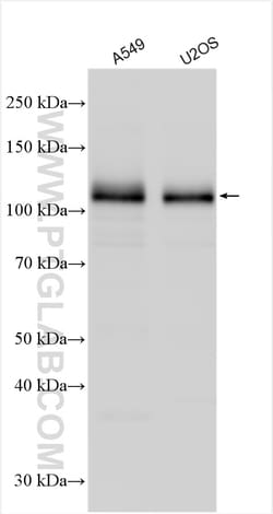 DCBLD2 Rabbit Polyclonal Antibody, Proteintech Unconjugated; 20 &mu;L:Antibodies,