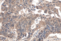 DDAH1 Rabbit Polyclonal Antibody, Proteintech:Antibodies:Primary Antibodies