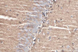 DDAH1 Rabbit Polyclonal Antibody, Proteintech:Antibodies:Primary Antibodies