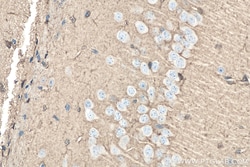 DDAH1 Rabbit Polyclonal Antibody, Proteintech:Antibodies:Primary Antibodies