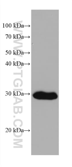DDAH2 Mouse Monoclonal Antibody, Proteintech:Antibodies:Primary Antibodies