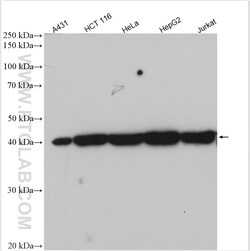 DDB2 Rabbit Polyclonal Antibody, Proteintech:Antibodies:Primary Antibodies