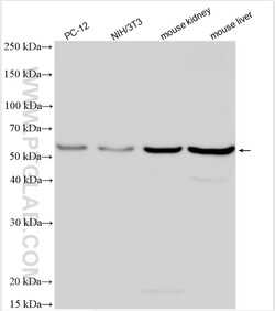 DDB2 Rabbit Polyclonal Antibody, Proteintech:Antibodies:Primary Antibodies