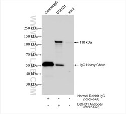 DDHD1 Rabbit Polyclonal Antibody, Proteintech Unconjugated; 150 &mu;L:Antibodies,