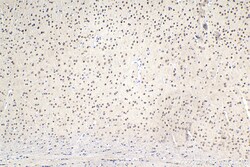 DDX1 Mouse Monoclonal Antibody, Proteintech:Antibodies:Primary Antibodies