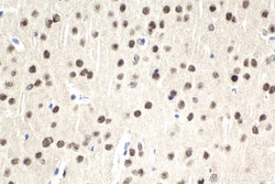 DDX1 Mouse Monoclonal Antibody, Proteintech:Antibodies:Primary Antibodies