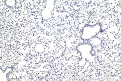 DDX1 Mouse Monoclonal Antibody, Proteintech:Antibodies:Primary Antibodies