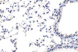 DDX1 Mouse Monoclonal Antibody, Proteintech:Antibodies:Primary Antibodies