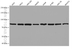 DDX1 Mouse Monoclonal Antibody, Proteintech:Antibodies:Primary Antibodies