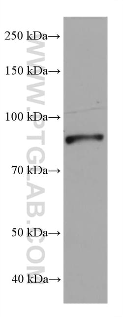DDX1 Mouse Monoclonal Antibody, Proteintech:Antibodies:Primary Antibodies