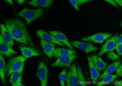 DDX3 Rabbit Recombinant Antibody, Proteintech:Antibodies:Primary Antibodies