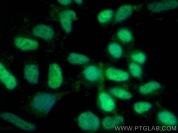 DFFA,DFF45 Mouse Monoclonal Antibody, Proteintech Unconjugated; 20 &mu;L:Antibodies,