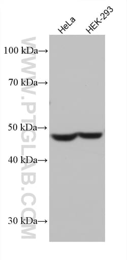 DFNA5 Mouse Monoclonal Antibody, Proteintech Unconjugated; 20 &mu;L:Antibodies,