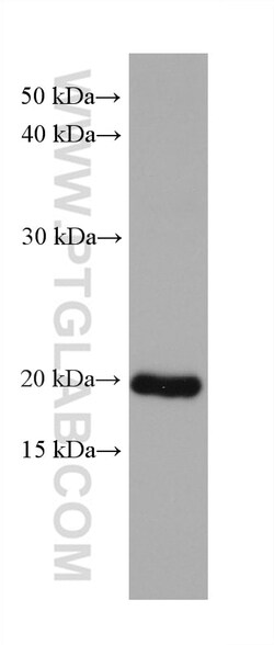 DHFR Mouse Monoclonal Antibody, Proteintech:Antibodies:Primary Antibodies