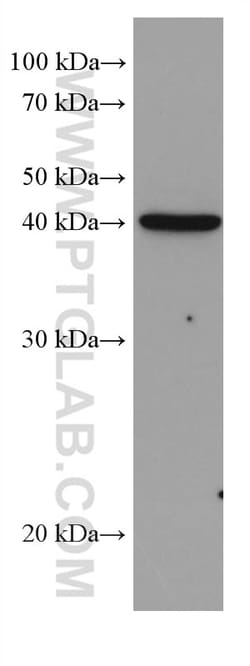 DHODH Mouse Monoclonal Antibody, Proteintech Unconjugated; 150 &mu;L:Antibodies,