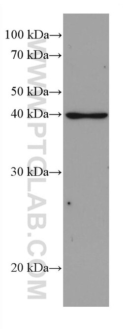 DHODH Mouse Monoclonal Antibody, Proteintech Unconjugated; 150 &mu;L:Antibodies,
